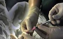 移植胚胎后并非一定要卧床休息，剧烈活动和负重应禁止！