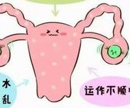 染色体易位在潍坊市妇幼保健院可以做三代试管吗？染色体平衡易位还能生健康的宝宝吗？