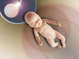 没有输卵管没排卵可以做试管？